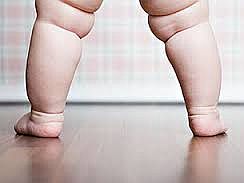 Obesidade infantil: o mal do século 21